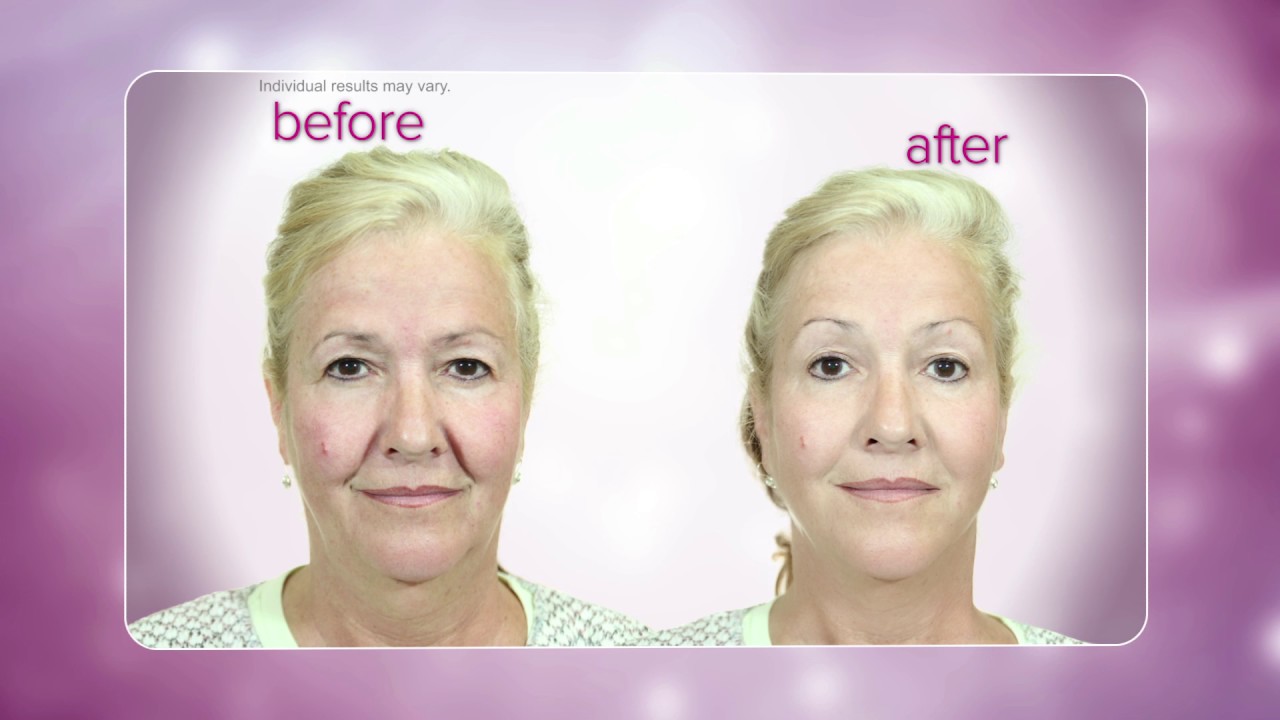 DEMO | DermaWand – Video